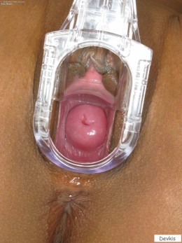 Внутри влагалища Влагалище - Внутри влагалища