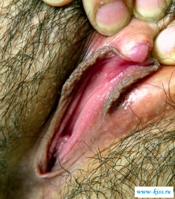 Несколько фото писек с крупными клиторами