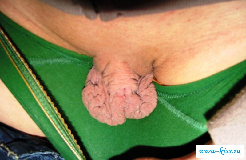 Фотки невообразимо больших клиторов