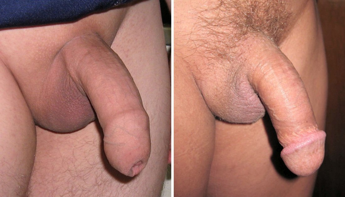 Gay blogs circumcision porn