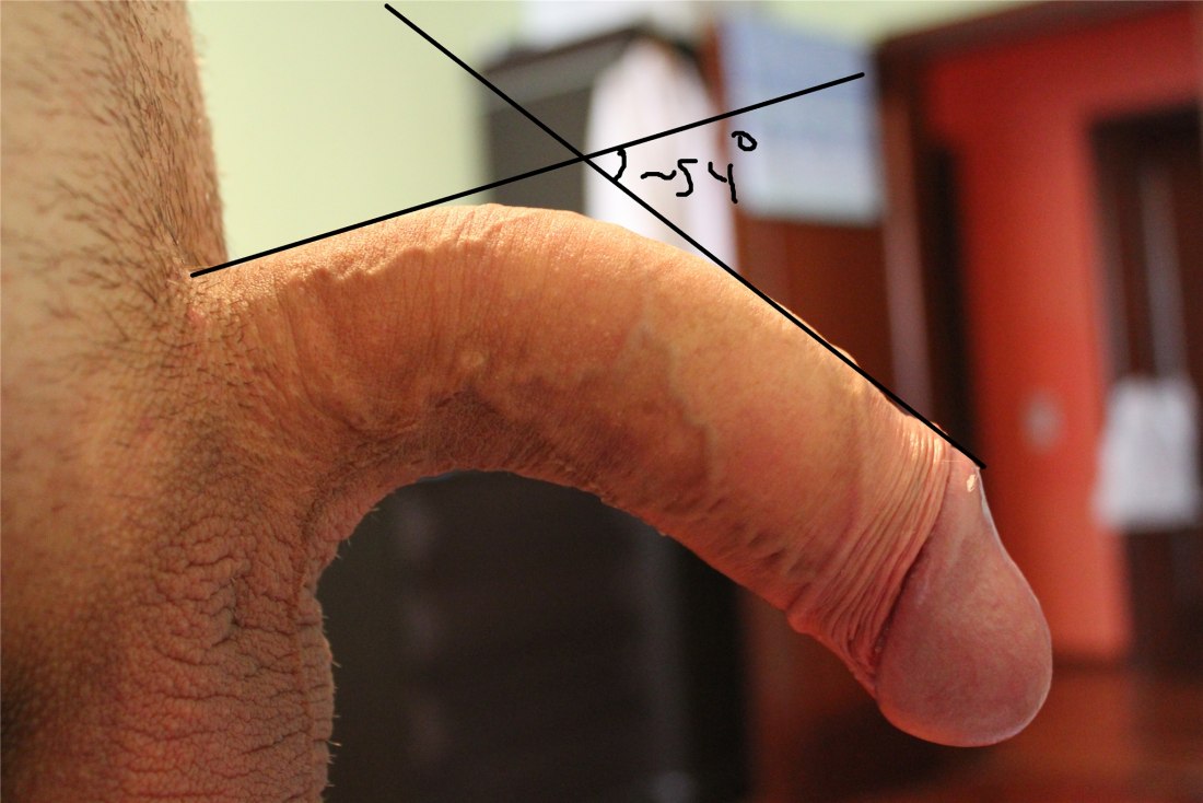 Член изогнутый в другую сторону