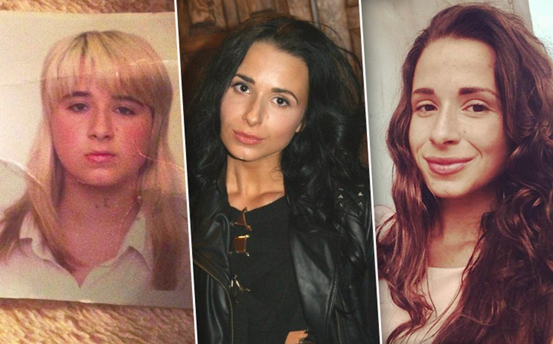 Мила Гриценко до и после