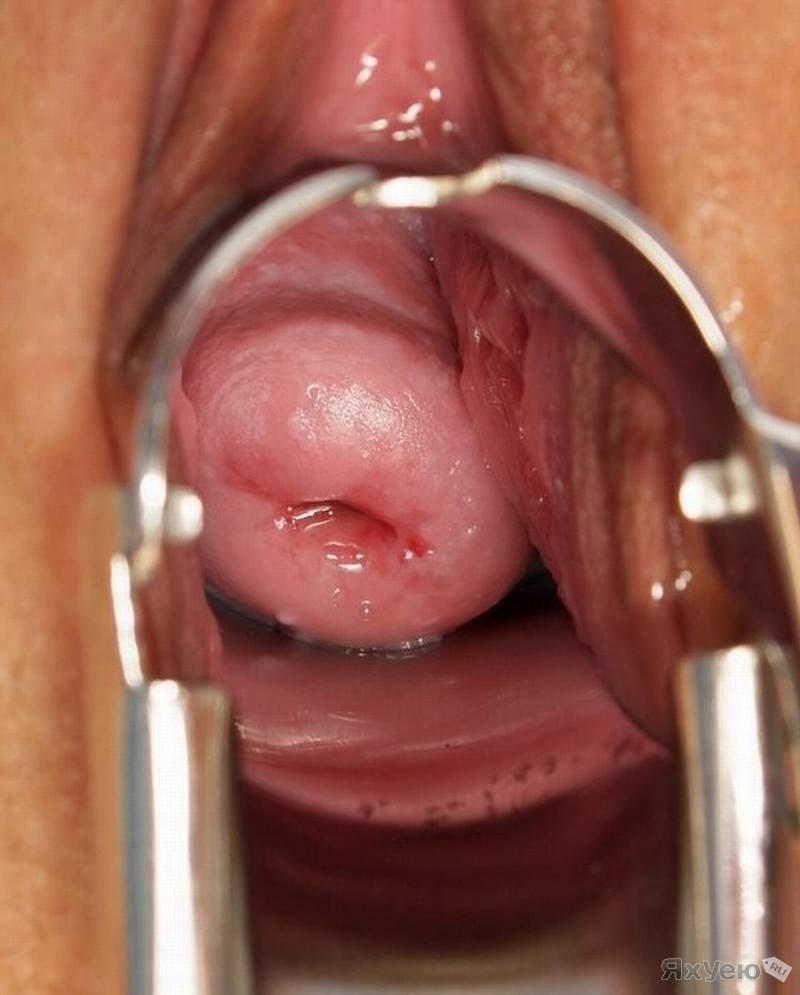 Вагина с помпой изнутри