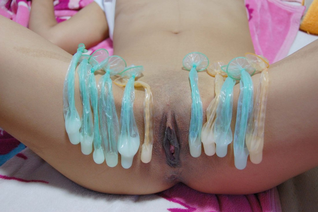 Использованные презервативы на животе