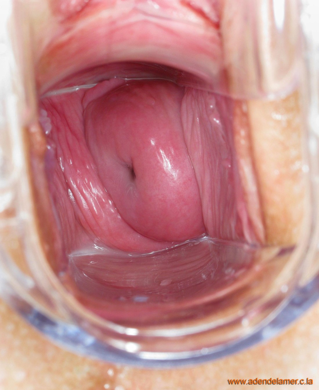 Матка и влагалище в разрезе