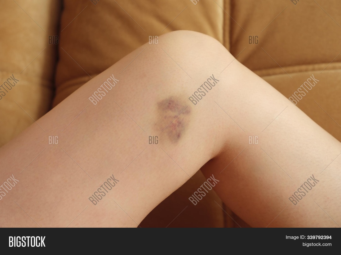 Sash Suicide girls(sex