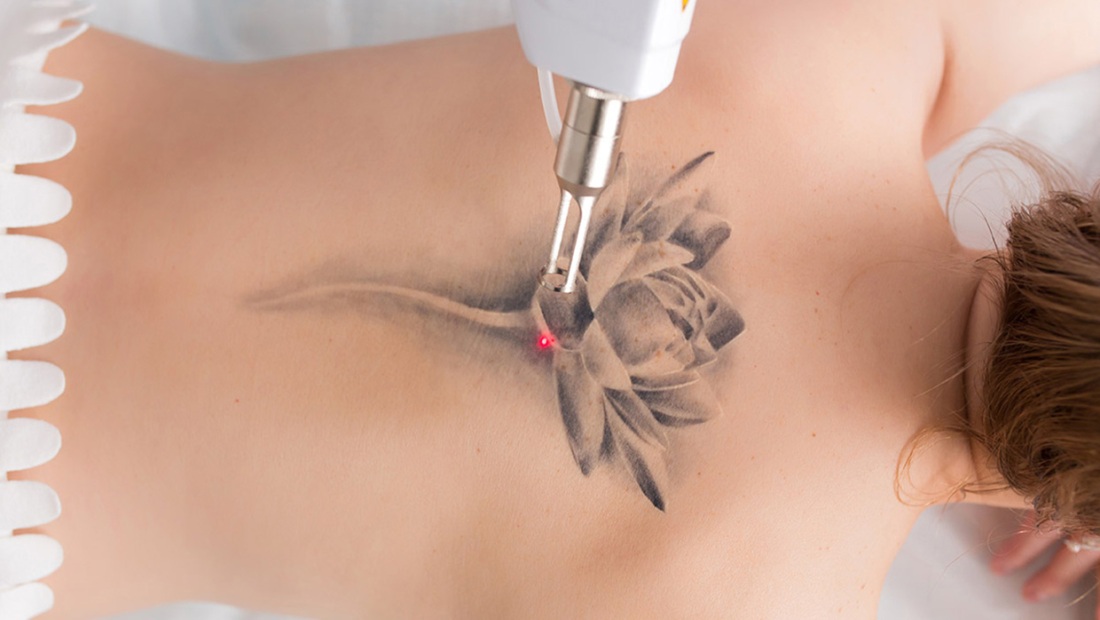 Тату молочной железы после мастэктомии