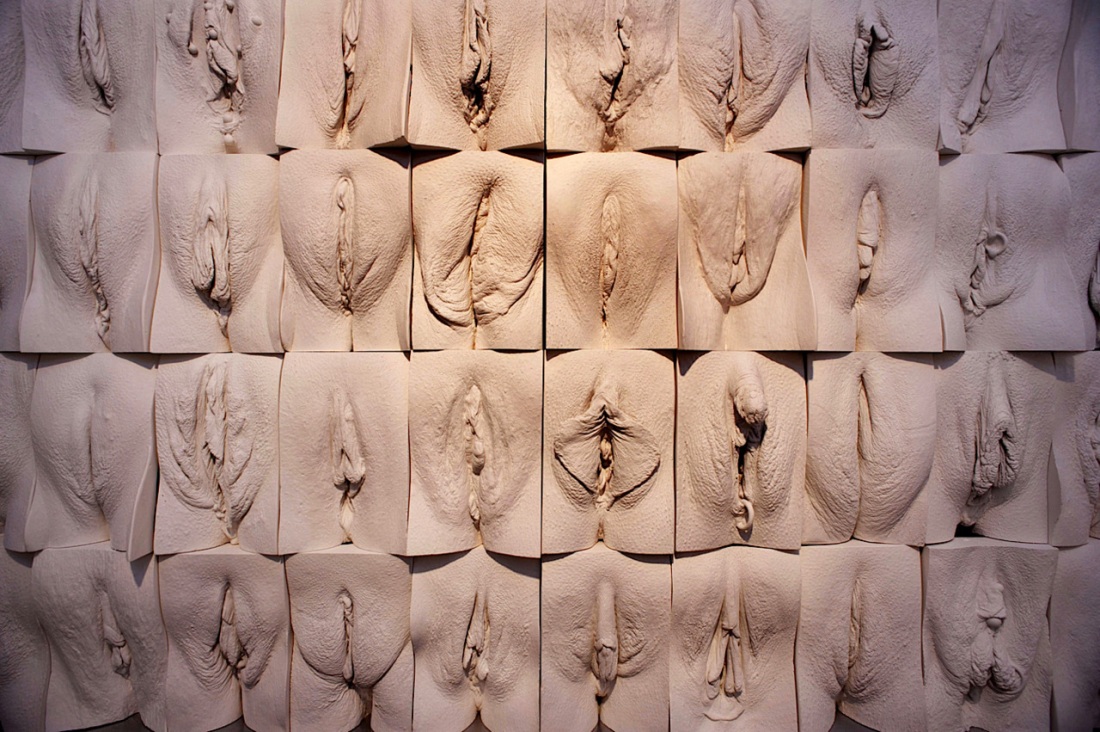 Высокое расположение вагины