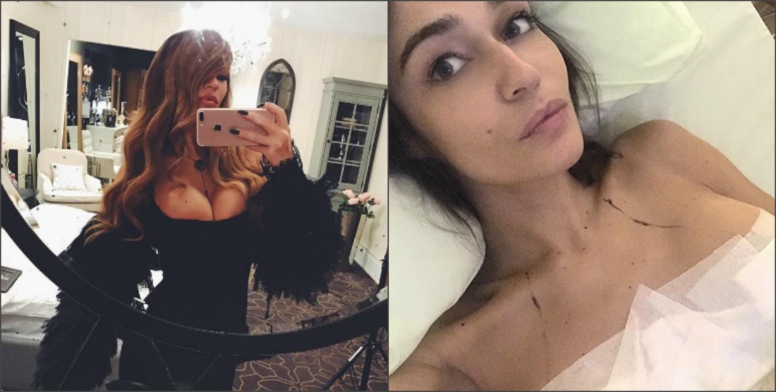 Айза Анохина пластические операции