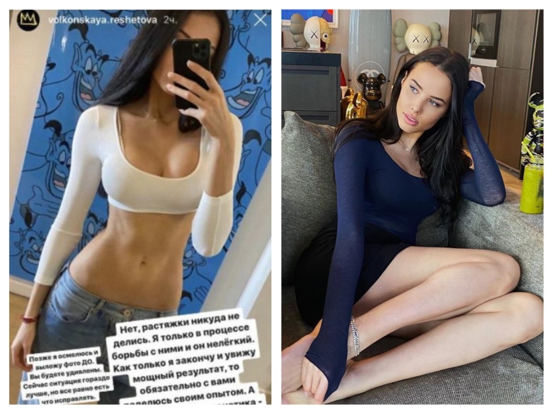 Анастасия Решетова целлюлит