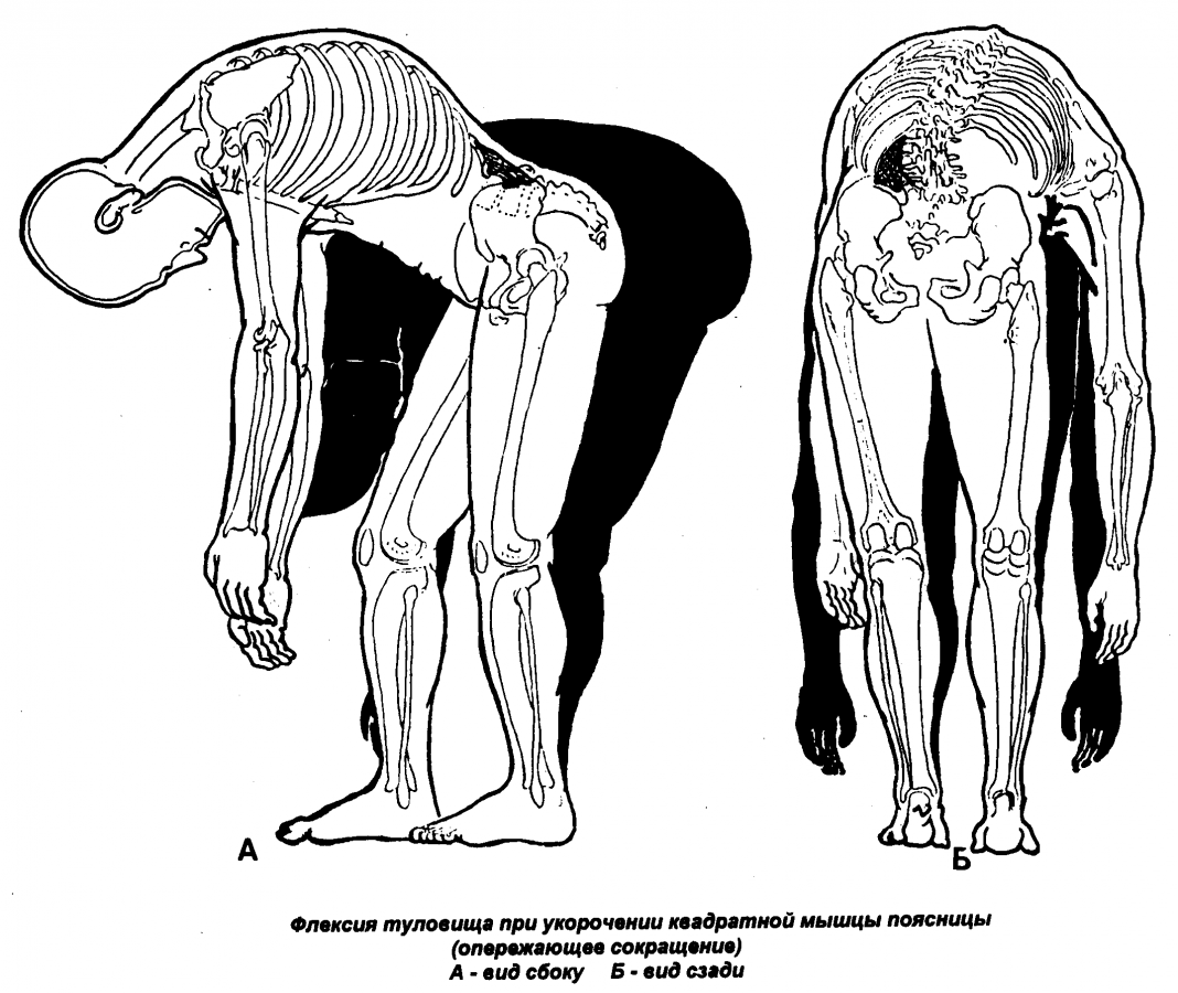 Латеральная флексия это