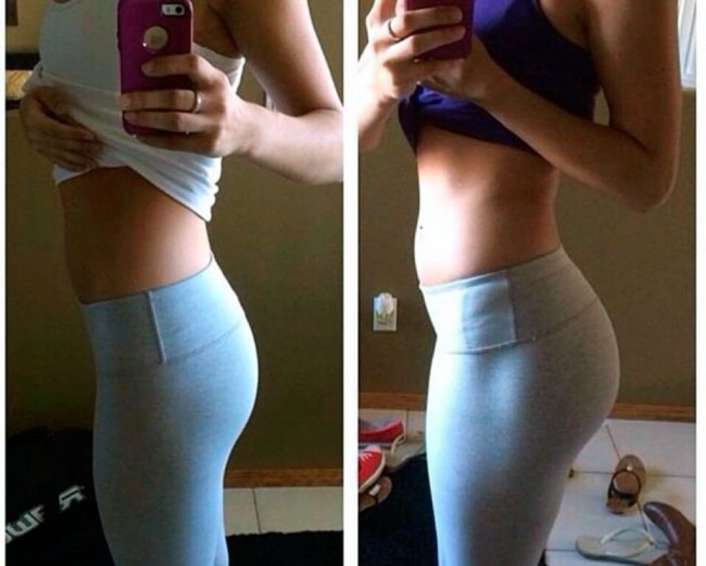 Попа до и после