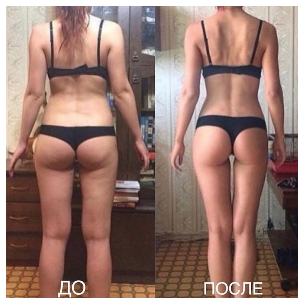 Коррекция фигуры до и после