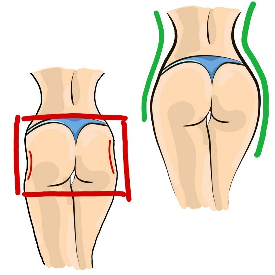 Формы ягодиц