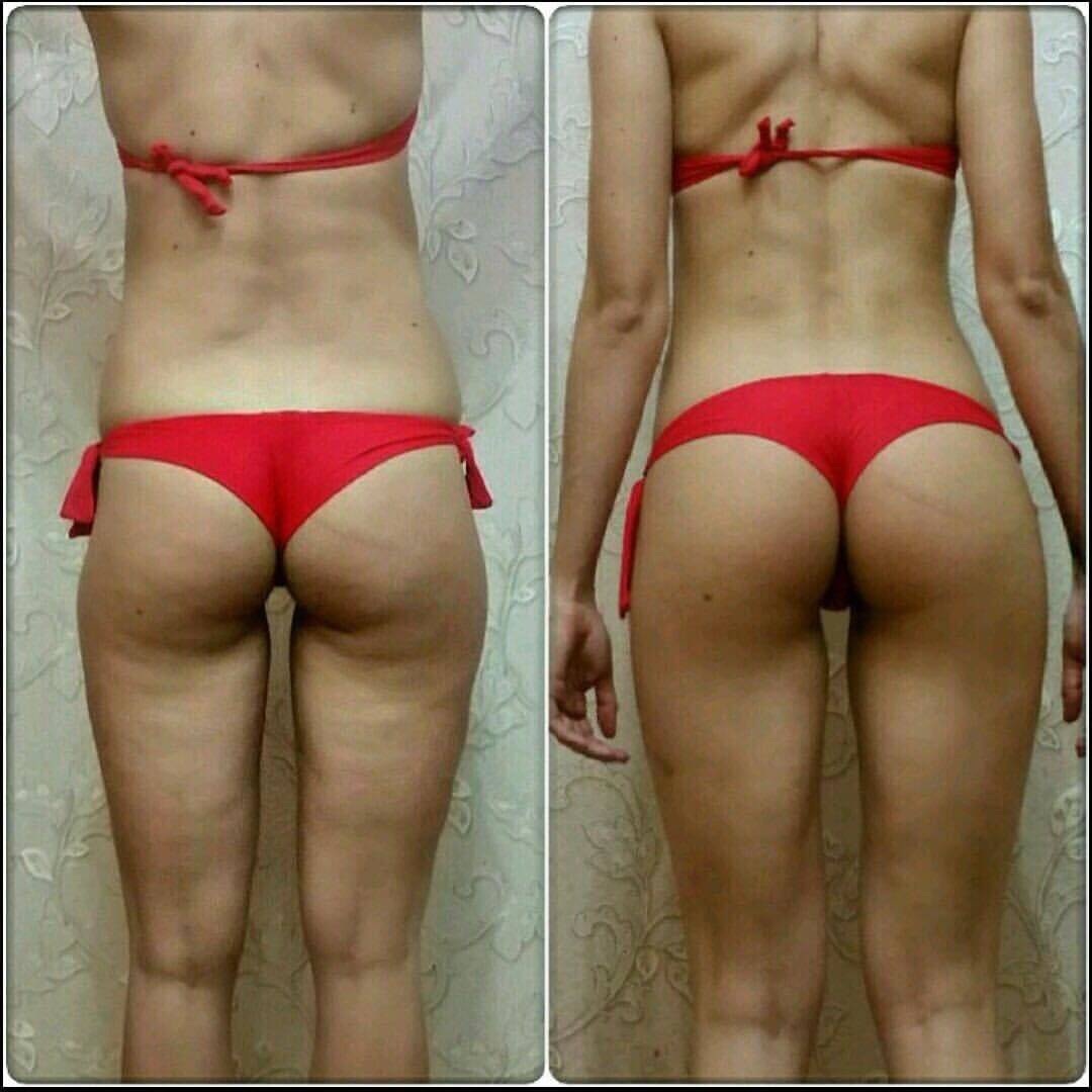 Плоские ягодицы