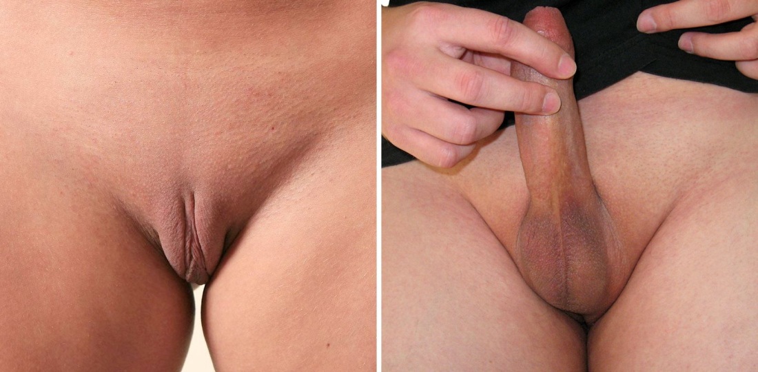 Самый большой женский клитор