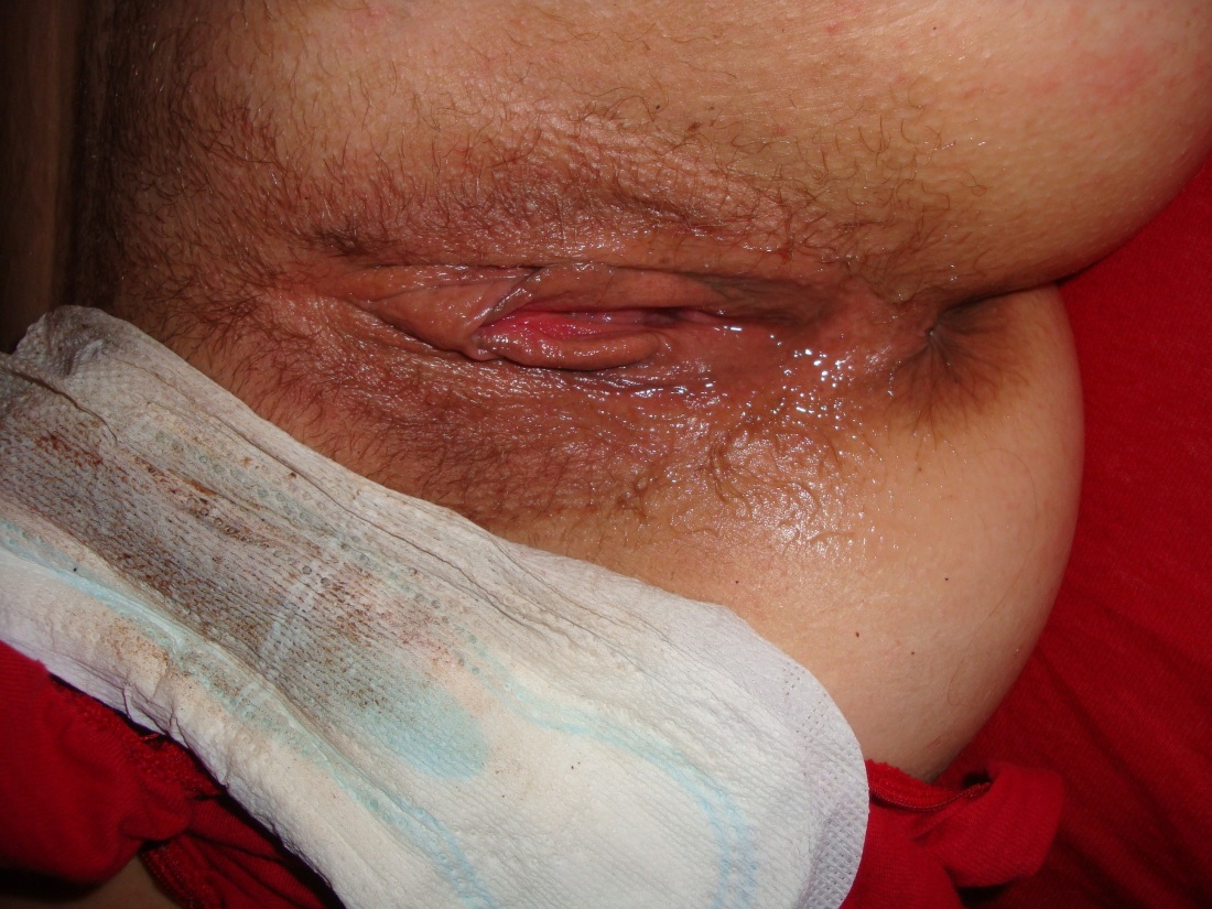 Менструация у зрелых баб картинки