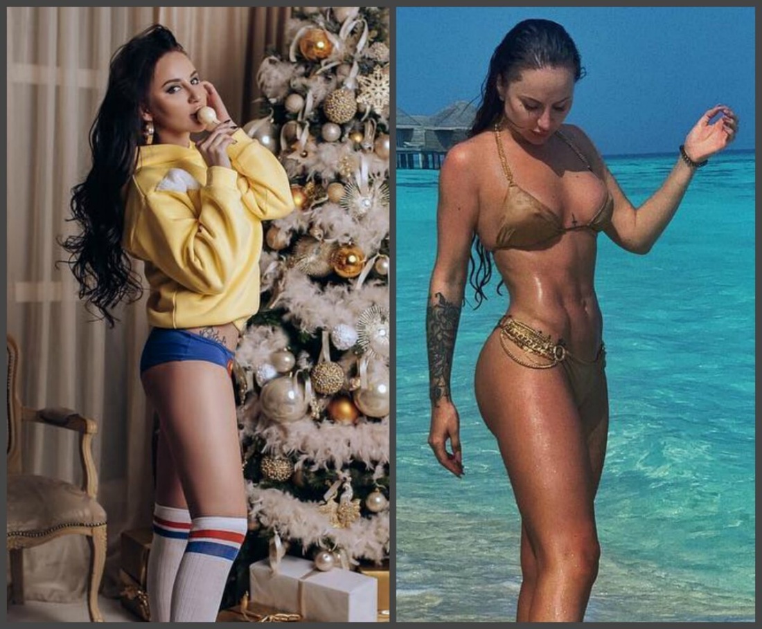 Анна Дзюба до пластики ягодиц