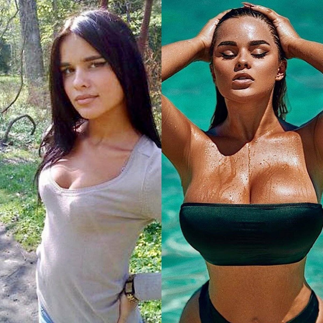 Настя Квитко до пластики