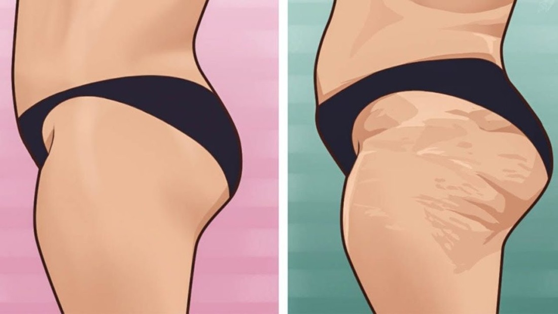 Жир на попе