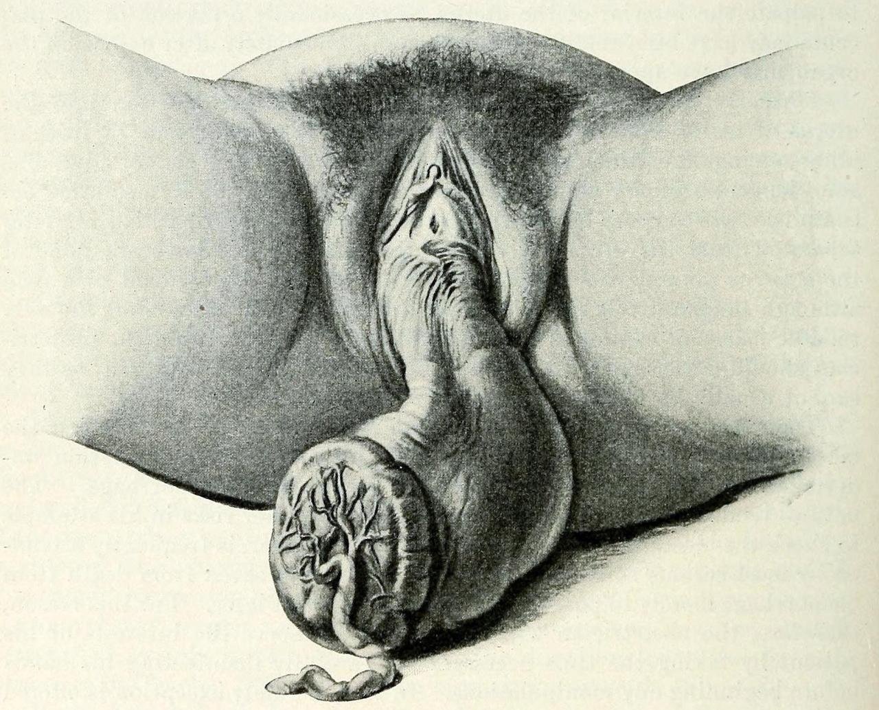 Erotic creatures coming out of womens vaginas sketches