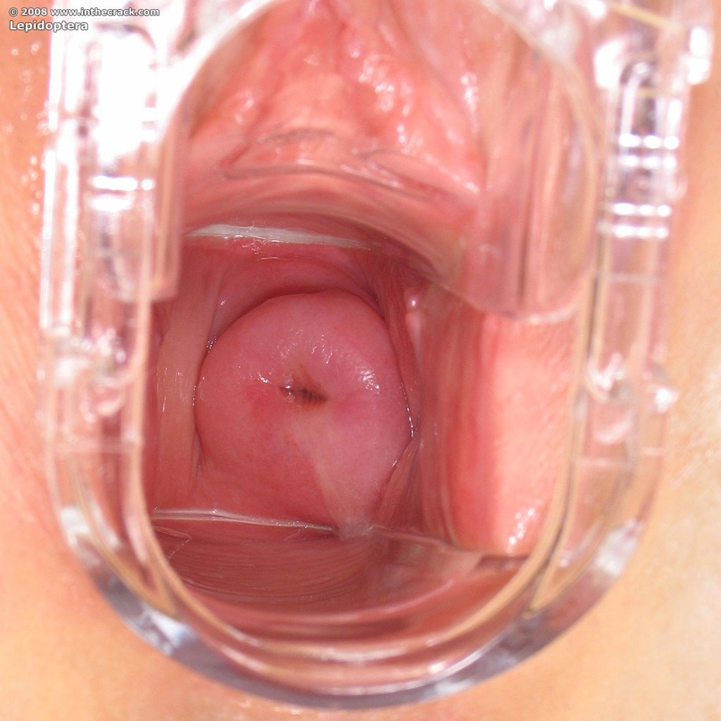 Хентай XRAY оплодотворение urethra