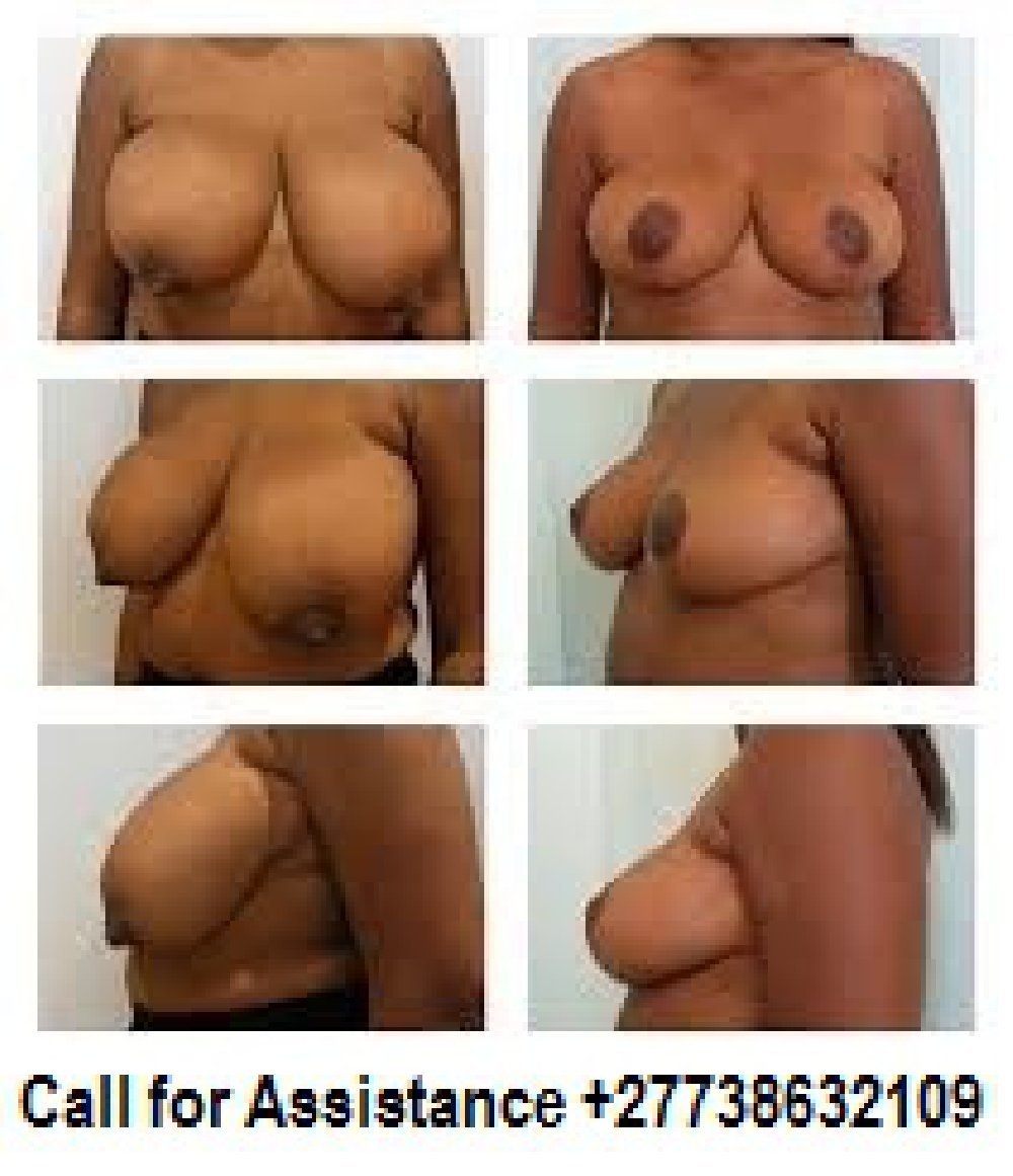 Голые сиськи разных форм