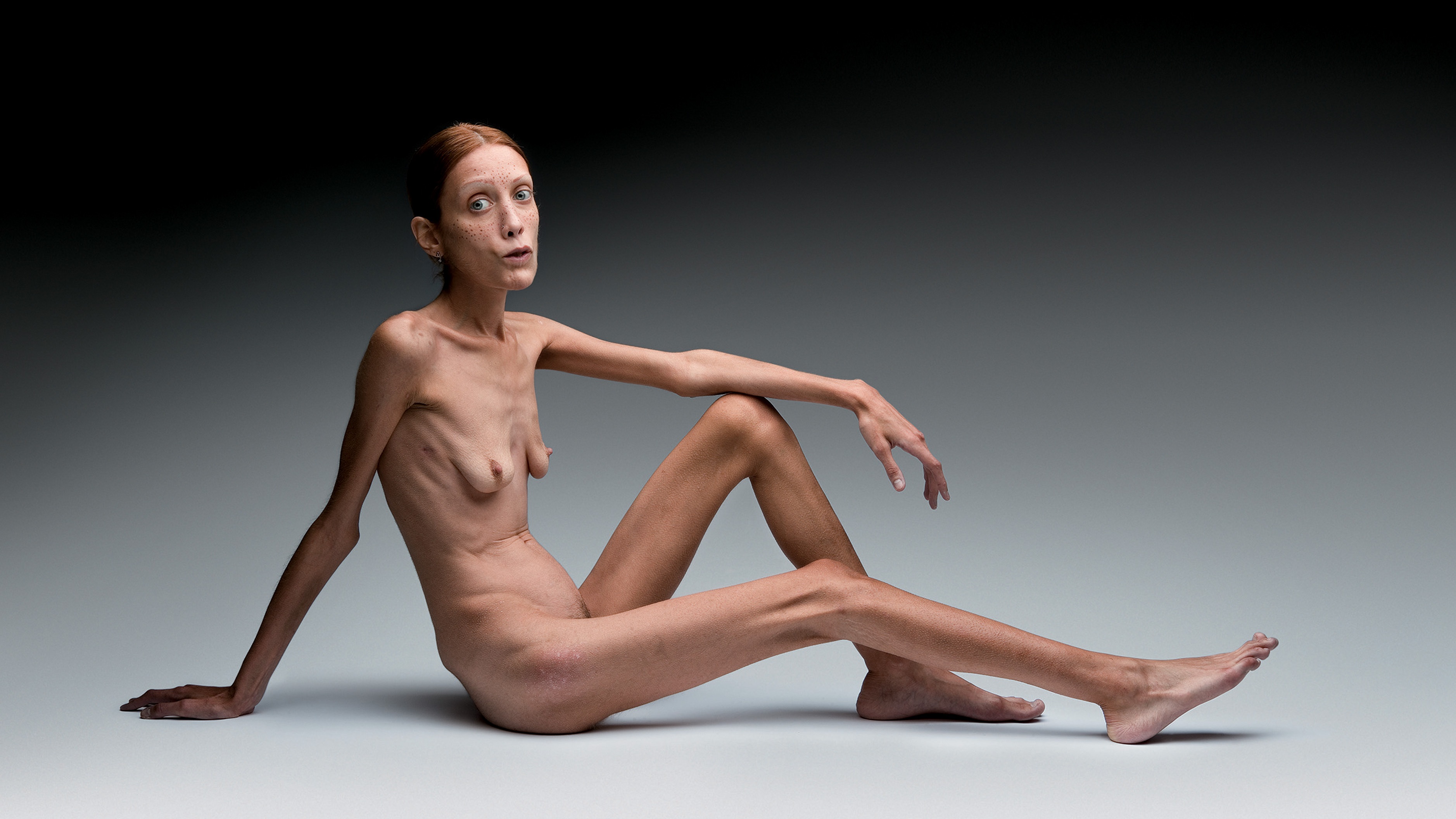 Nude Anorexic Women