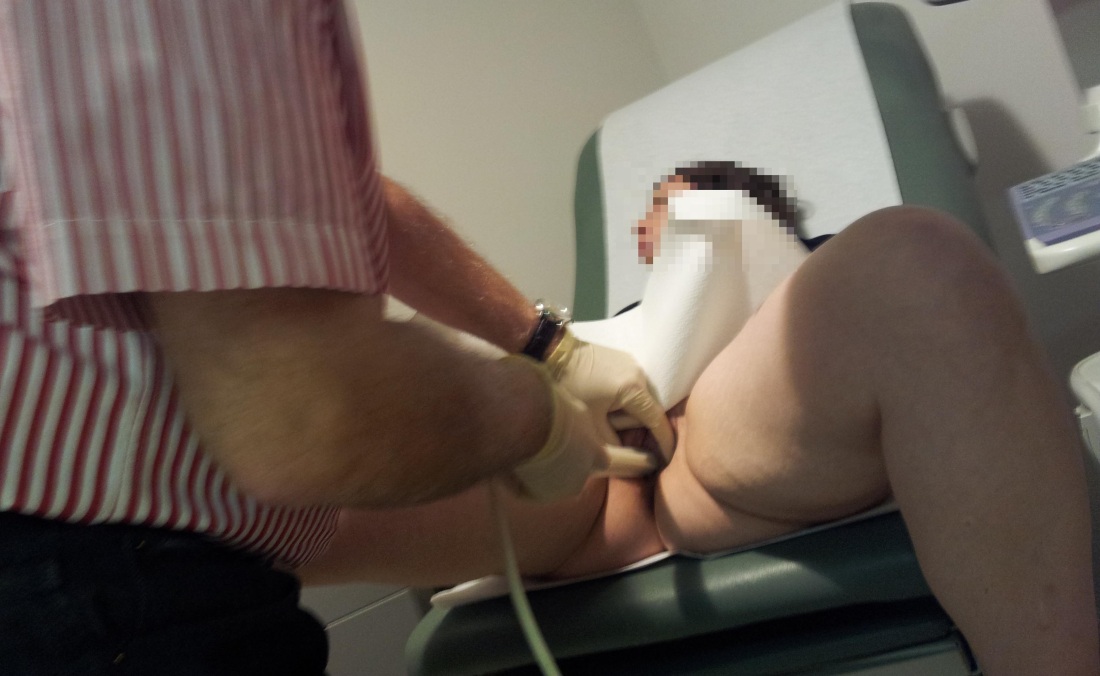 Скрытая камера в гинекологическом кресле