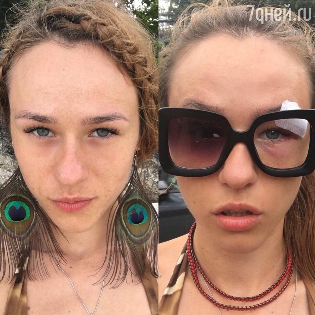 Iowa до операции