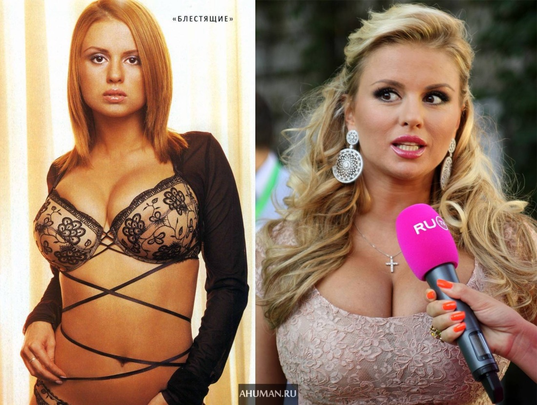 Анна Семенович в молодости и сейчас