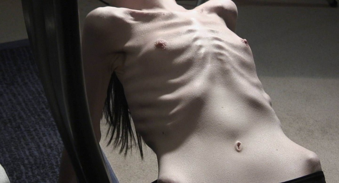 Порнозвезды Анорексички