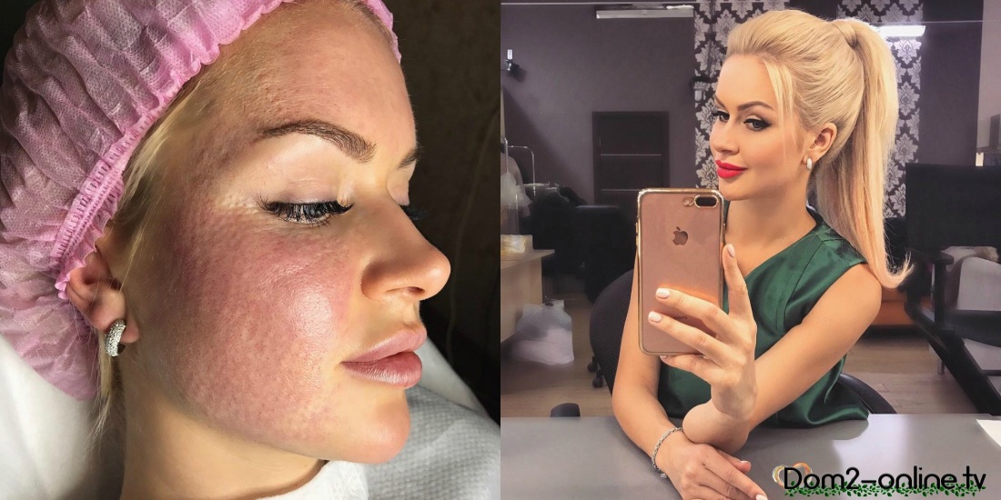 Марина Африкантова без макияжа