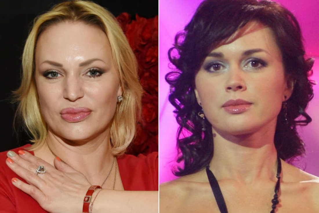 Алла Довлатова до пластики