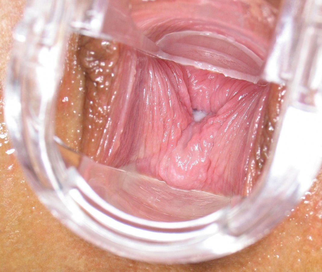 порно изнутри вагины фото 24