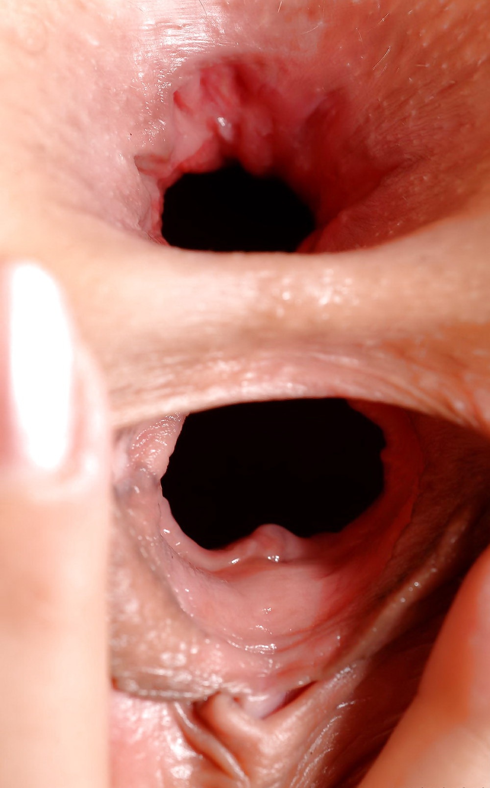 Алексис грей вагинальный расширитель