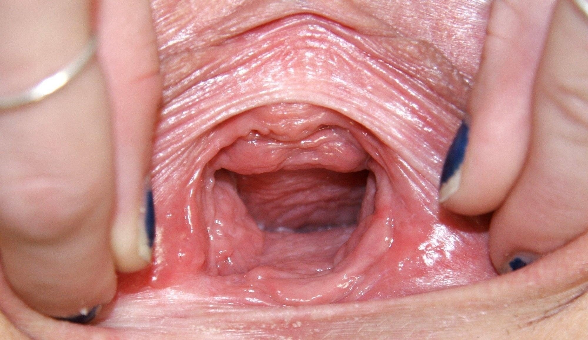 может ли сперма с половых губ попасть во влагалище фото 3