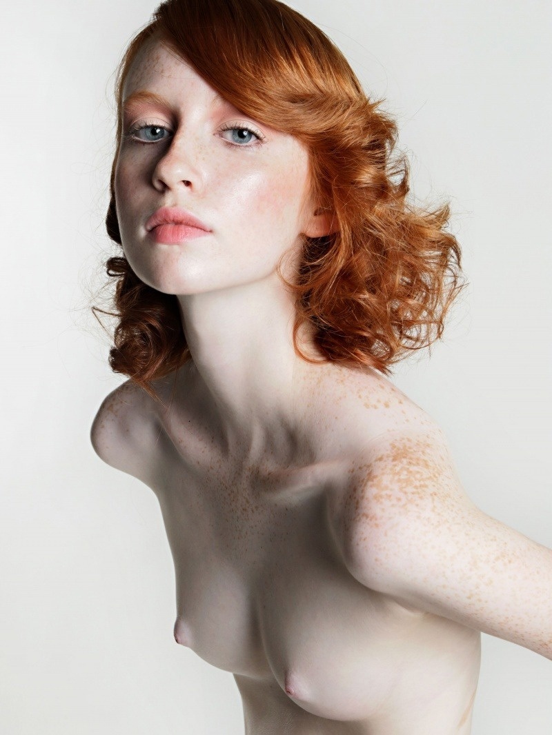 Abby Vissers