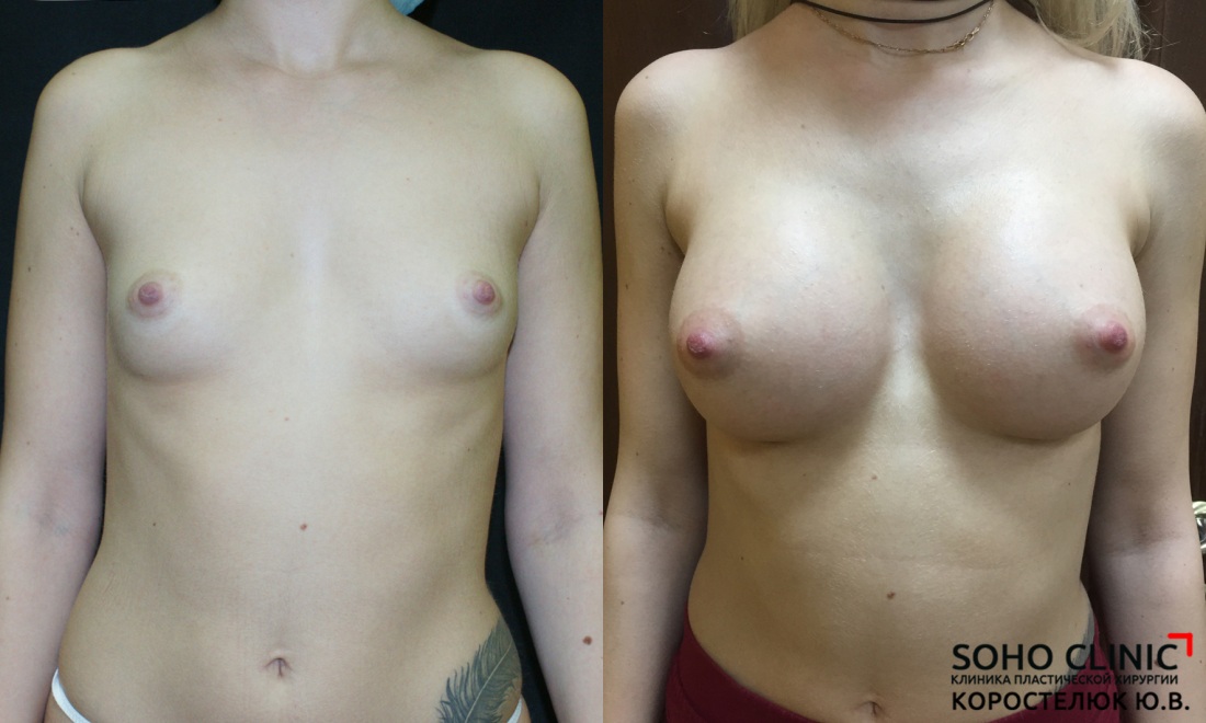 Анна Кристал порноактриса