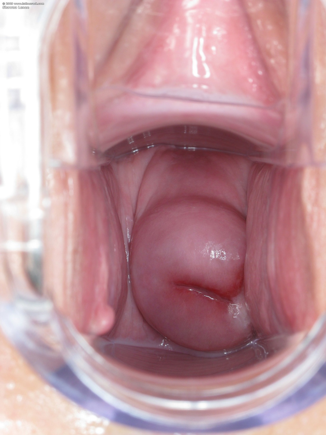 Строение влагалища фото