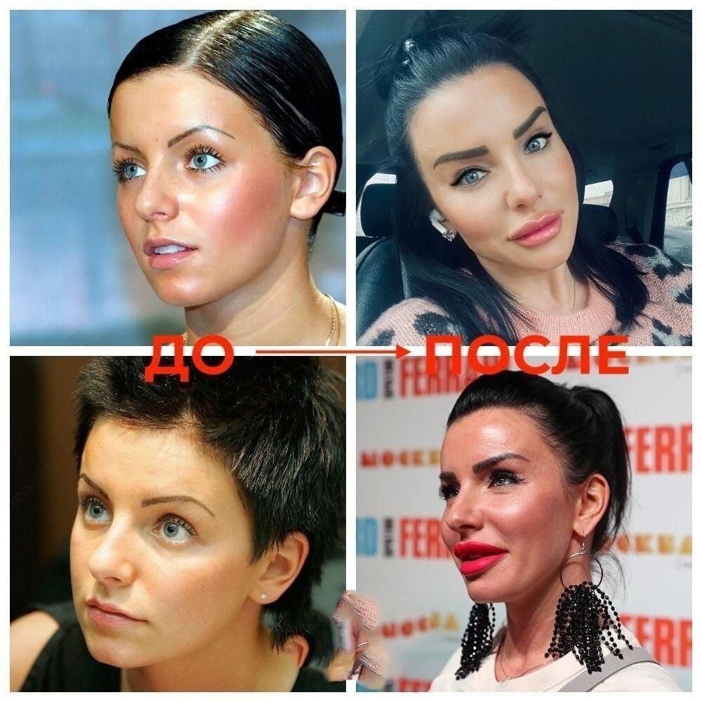 Юля Волкова пластика