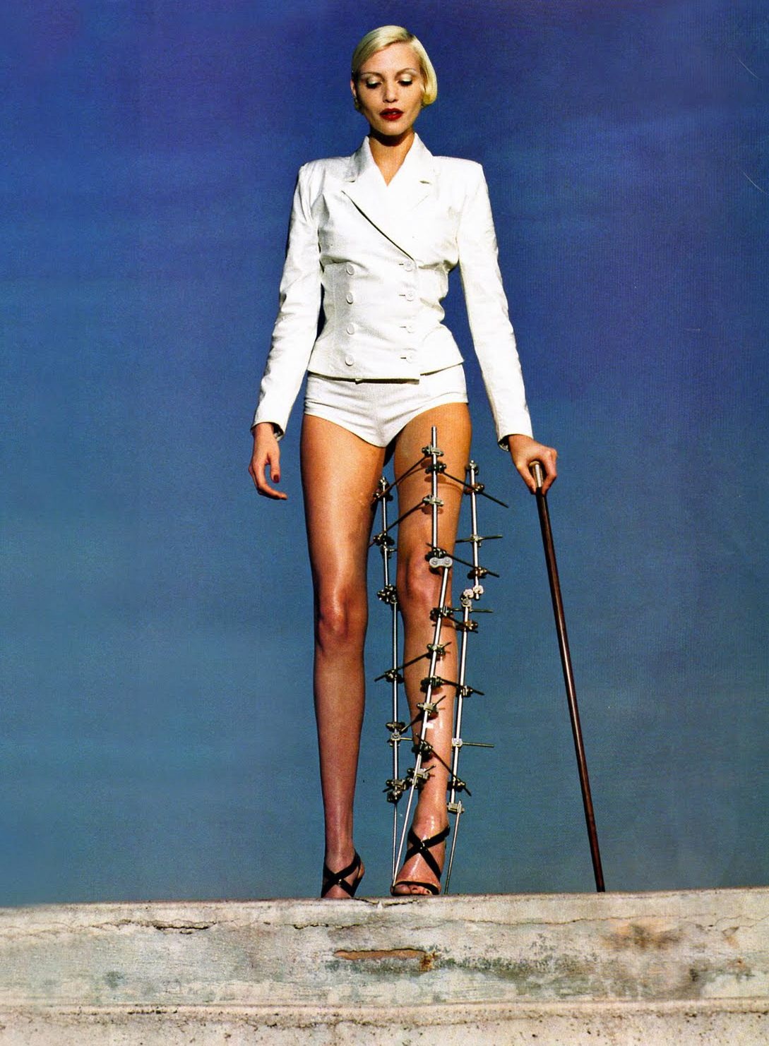 Красивая девушка с гипсом на ноге