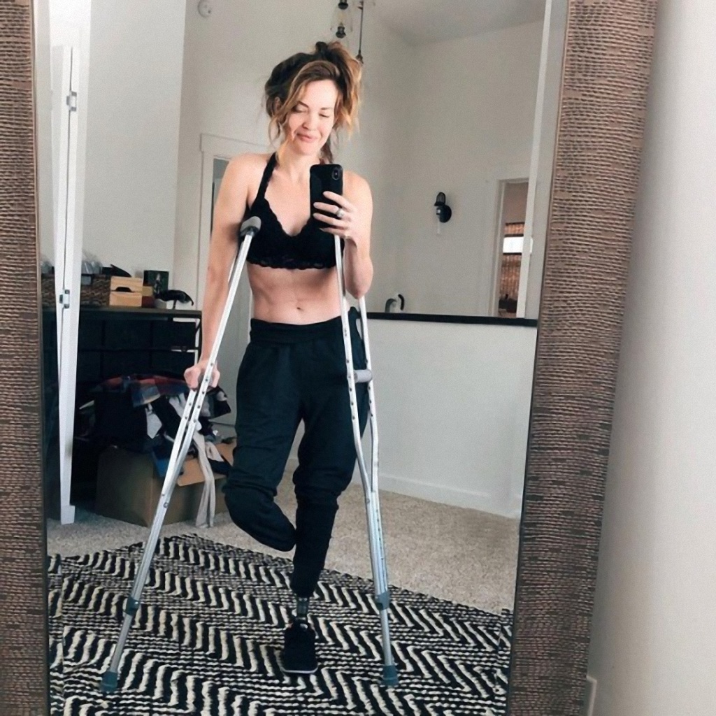 Одноногая женщина ампути 2018