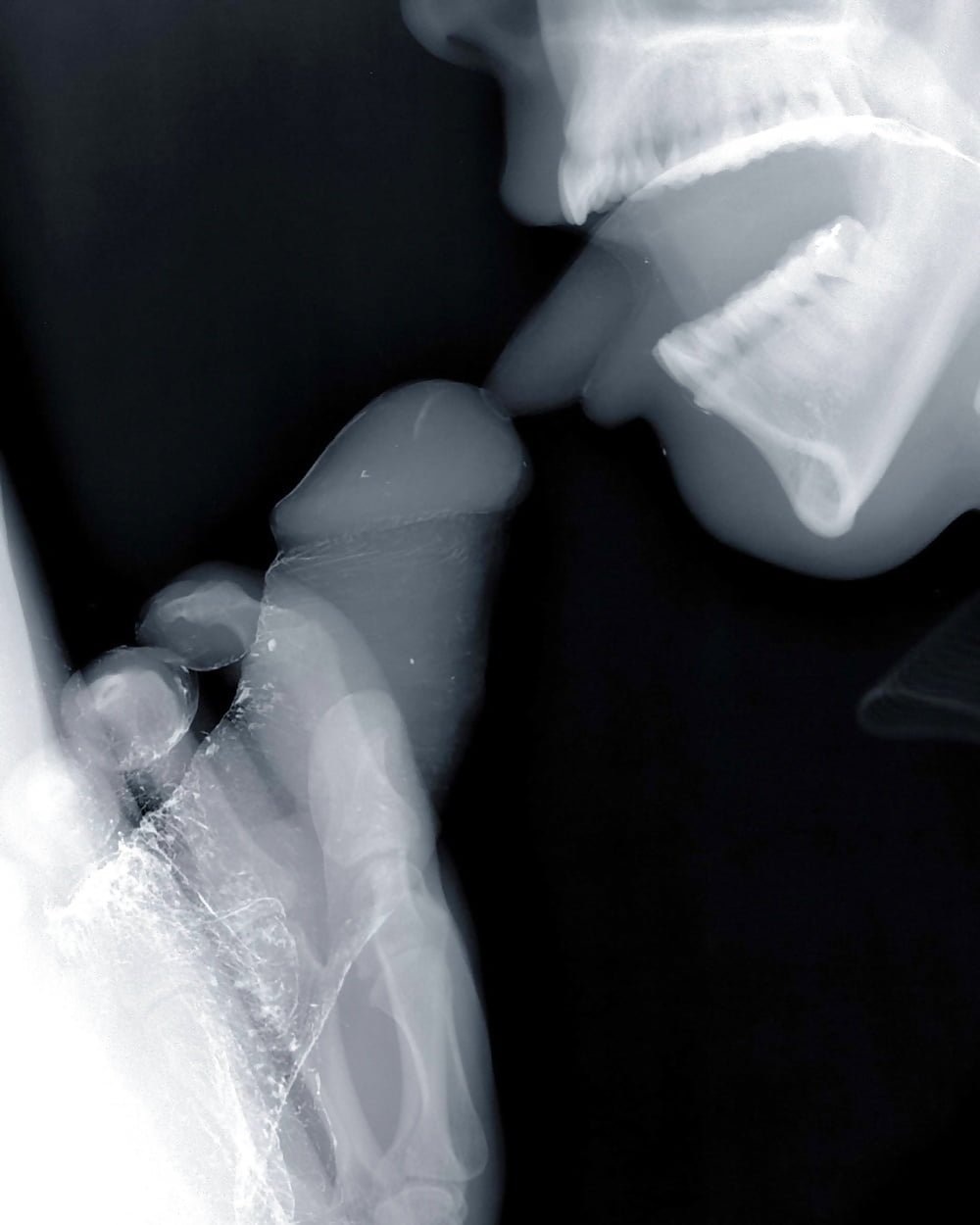 Член во рту рентгеновский снимок