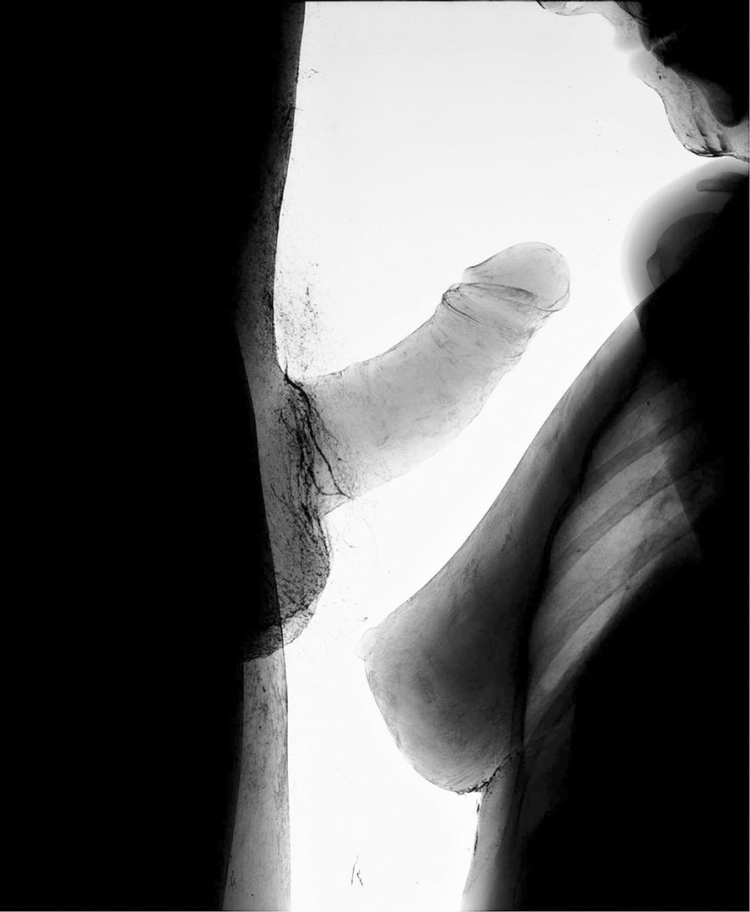 Рентген ххх