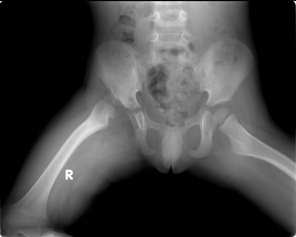 Половые органы на рентгене