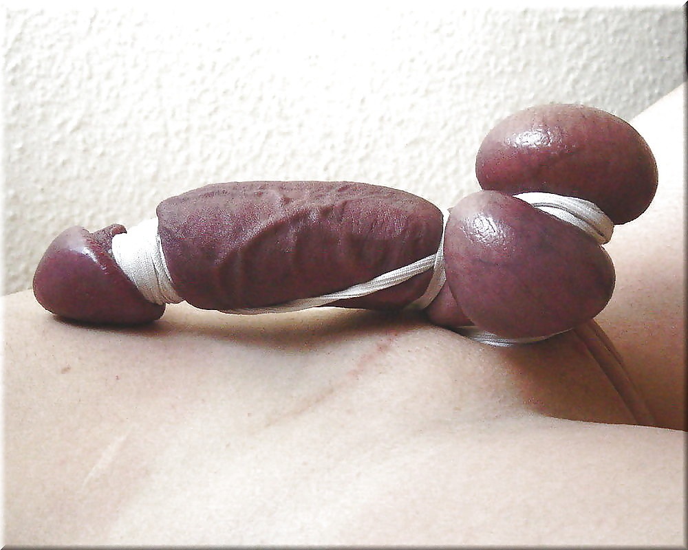 Перевязывание пениса и мошонки