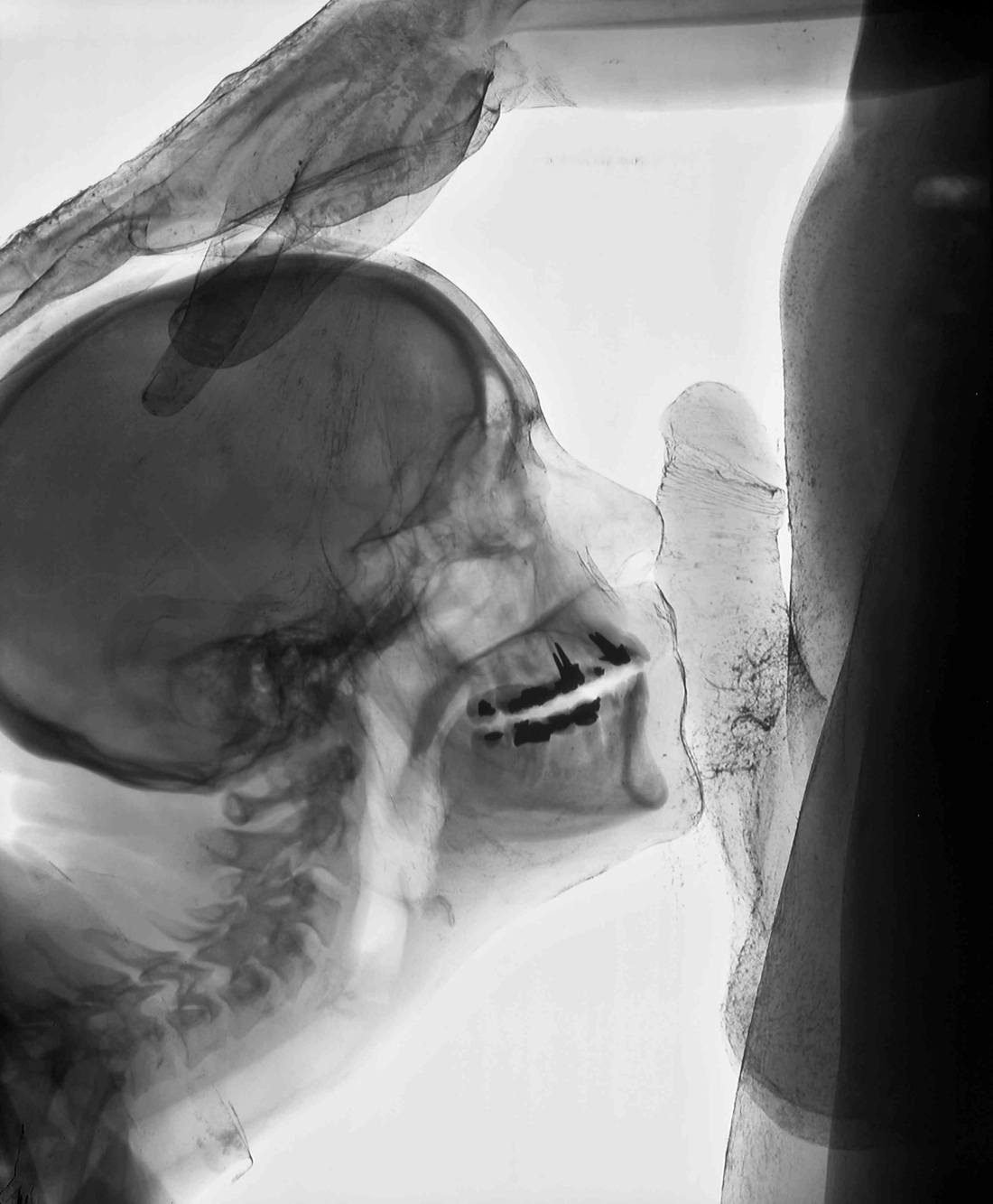 Под рентгеном