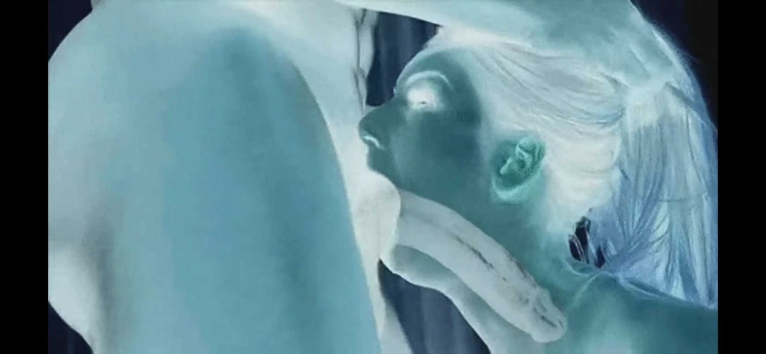 Глубокий Заглот рентген