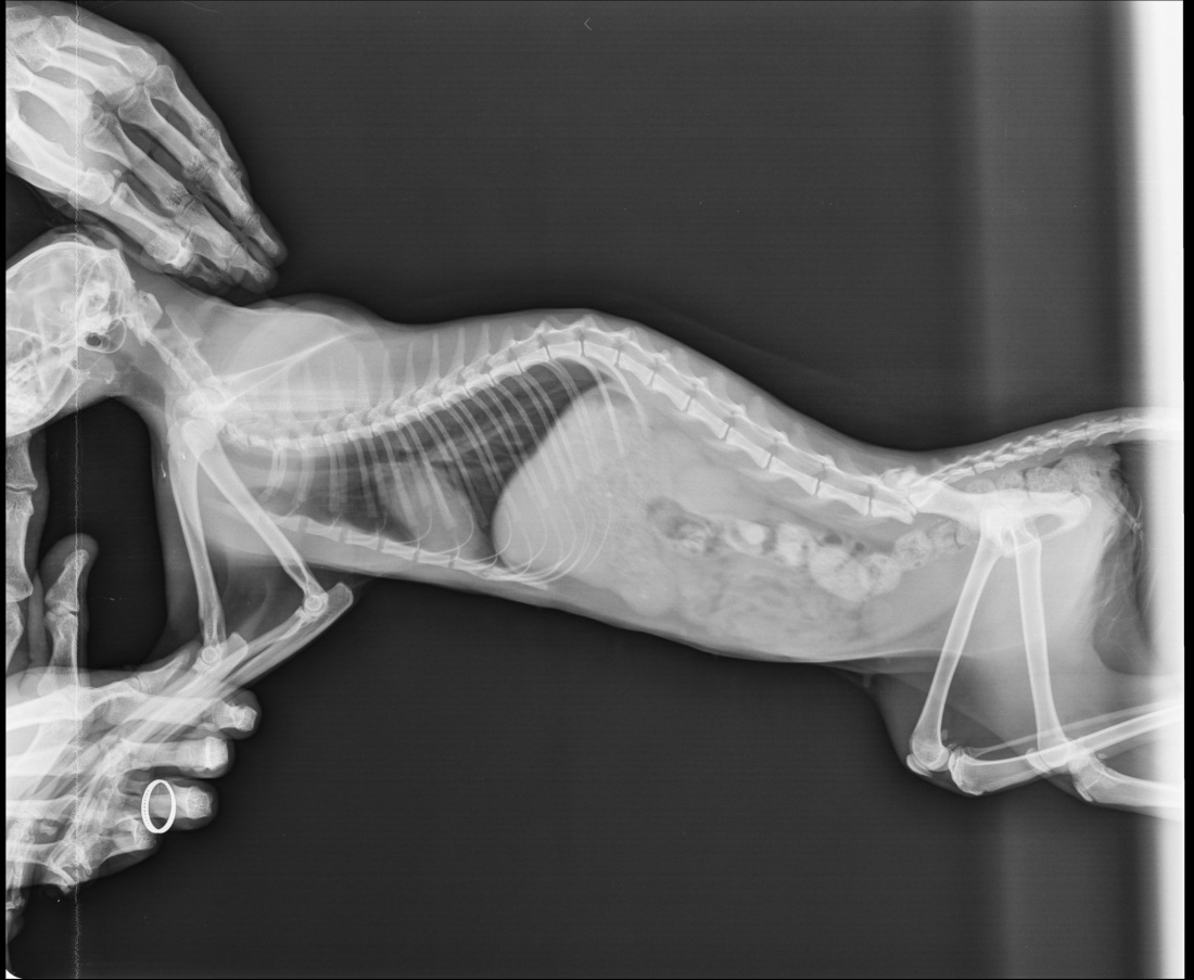 Рентгеновский снимок влагалища